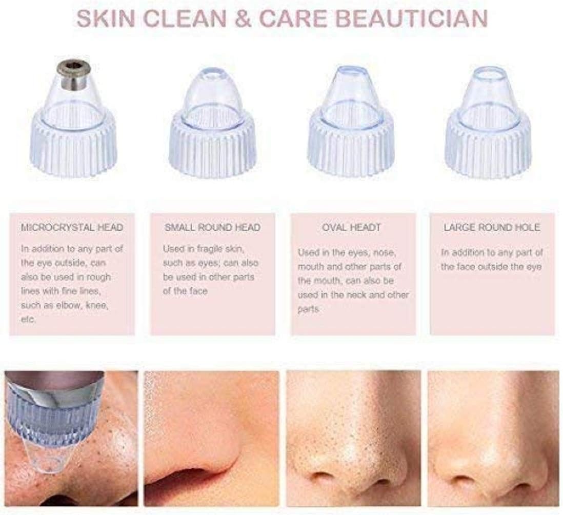 Derma Suction Facial Pore Cleanser - Deep Cleaning Pore Vacuum for Blackhead & Oil Removal